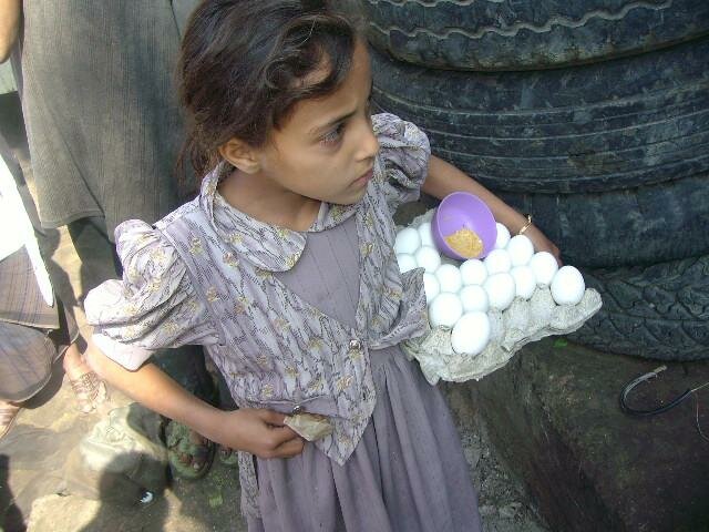 أطفال الشوارع والأطفال العاملين ... ضحايا الجهل والقبيلة في اليمن أطفال الشوارع والأطفال العاملين ... ضحايا الجهل والقبيلة في اليمن